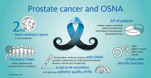 The american cancer society estimates that over 21,000 people in the united states will be diagnosed with ova. Prostate Cancer