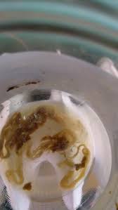 Parasiten gibt es überall auf der welt, auch in den industrienationen. Darm Parasiten Symptome Und Behandlung Heilwege Fur Mensch Tier Parasiten Des Menschen