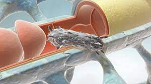 So wäre es dem wiener forscher zufolge durchaus denkbar, die pumpenblockade bei besonders schweren fällen von epilepsie anzuwenden. Tatort Blut Hirn Schranke Medizin Therapie Multiple Sklerose News Amsel E V