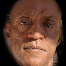 TOP 10 BEST Varicose Vein Treatment in San Leandro, CA