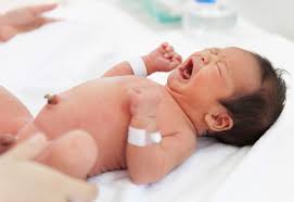 Hernia Umbilical En Bebes Y Ninos Lo Nunca Contado