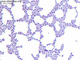 Monocytogenes in ovine brain tissue. Listeria Images Infectious Disease Images Emicrobes Digital Library Atlas