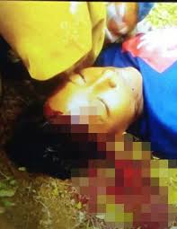 Seorang pelajar perempuan maut manakala dua lagi pelajar lelaki cedera akibat terkena bilah pisau traktor pemotong rumput di. Terkena Pisau Babat Rumput Di Bagian Kepala Seorang Pelajar Smp Tewas Metrokampung Com