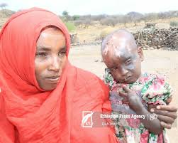 Terrorist TPLF left indelible scar against the people of Afar: Fatuma  Kssagita victim ***************** Fatuma Deto is a mother of three and a  resident of Wekartu Fursa Kebele located around Atekom, Kssagita