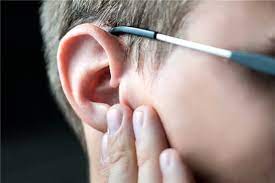 What Are Keloids And Do They Have To Be Removed Raleigh Capitol Ear Nose Throat