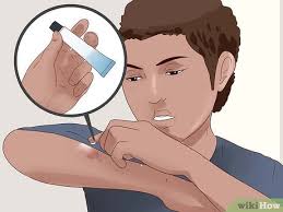 How to Treat Road Rash: Causes, Treatment & Prevention