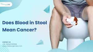 Image result for Blood in stool