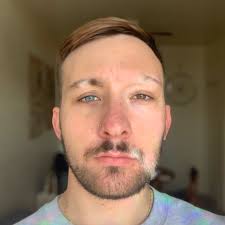 Image result for Vitiligo