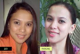 как быстро отбелить лицо от загара в домашних условиях Kak Otbelit Kozhu V Domashnih Usloviyah Kak Otbelit Lico Ot Zagara