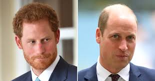Prince Harry: Prince William Balding Is ...
