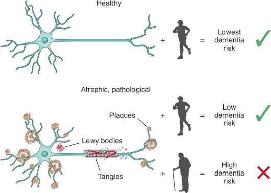 The degree of frailty as a translational measure of health in aging |  Nature Aging