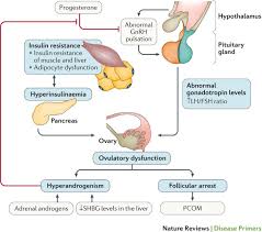 Women with polycystic ovarian syndrome (pcos) have abnormalities in the metabolism of androgens and estrogen and in the control of androgen production. Polycystic Ovary Syndrome Nature Reviews Disease Primers