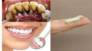 Now add lime juice and apple cider vinegar into the bowl and mix well and the mixture will react with baking soda and look acidic but not to worry it is totally natural. How To Whiten Teeth At Home In 3 Days And Remove Tartar And Black Teeth Black Teeth Remove Tartar Tartar Teeth