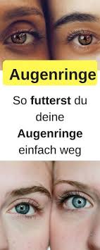 Wir bekommen schuppen, brüchiges haar, oder gar schuppenflechte. 45 Thermomix Medizin Ideen In 2021 Heilkrauter Gesundheit Krauterkunde