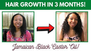 › monistat hair growth | blackdoctor › how to use monistat 7 for hair growth | hair growth challenge › one of my secrets to hair growth. 3 Months Postpartum Oily Hair Novocom Top