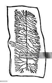 Image result for Beef Tapeworm