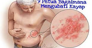 Umur yang semakin meningkat (lebih daripada 50 tahun) di mana ketahanan. 9 Petua Bagaimana Mengubati Kayap Permata Ummi