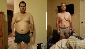 This statistic proves that one should think long and hard about the consequences of gastric bypass before and after the procedure. Bryan J Alabama Surgical Associates