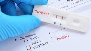 Koronavirüs testlerinin yapılışı ve acıtıp acıtmadığı bazı vatandaşlar tarafından merak konusu oldu. Corona Testi Rezaleti Vatandasin Gunlerce Bekledigi Sonuc Akp Lilere Jet Hizinda Verildi Son Dakika Haberleri
