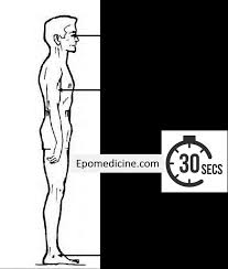 Image result for Romberg Test