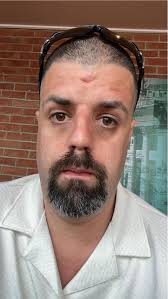 Cat joins owner for a drink at a bar