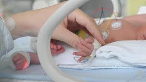 Bayi Lahir Prematur Lebih Baik Di Usia 7 Bulan Daripada 8 Bulan Benarkah
