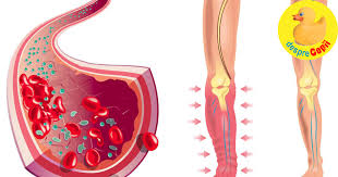 Acum sunt insarcinata in 5 sapt. Ce Este Trombofilia Si De Ce Pare Sa Fie Atat De Populara In Romania Desprecopii Com