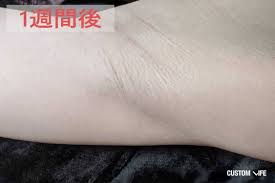 カスタムライフ