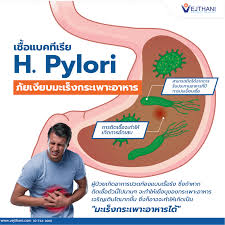 เชื้อแบคทีเรีย H.Pylori ภัยเงียบมะเร็งกระเพาะอาหาร - Vejthani Hospital
