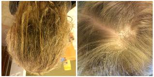 Repairing Chlorine Damaged Hair Chlorine Damaged Hair Hair Remedies Damaged Hair