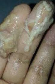 This might not make a lot of sense on the surface, but this discharge has an essential job. Discharge Of Clear Liquid During Pregnancy 5 Weeks Steemit