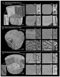 Image result for Strombosiopsis tetrandra