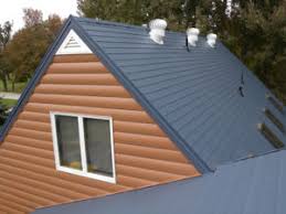 Maybe you would like to learn more about one of these? What Is The Life Expectancy Of A Metal Roof Abc Seamless