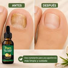 COMBINADO 2x1 | TRATAMIENTO ANTI HONGOS 7 DÍAS 100% NATURAL – CO Tienda Santa Elena