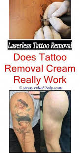 Can you tattoo over a removed tattoo? Pin On Tattoo Removal
