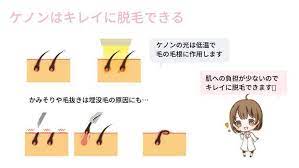 ケノンの脱毛原理 ケノン 脱毛 脱毛器