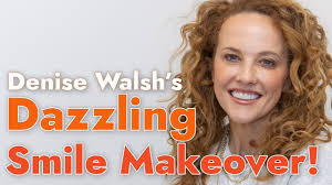 🌟 Denise Walsh's Dazzling Smile Transformation! 🌟