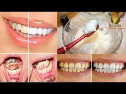 Pin En Dientes