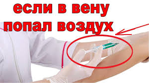 что будет если через капельницу в вену попадет воздух Chto Budet Esli Sdelat Ukol S Vozduhom V Venu A Esli Vozduh Uzhe V Vene Youtube
