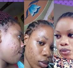 Bosi wangu unakwama wapi kuanza kutumia full package ya mama MAOFA??? Dada  Anna anasema baba chanja sasa anaweweseka kwa jinsi alivyopendeza na full  package ya mama MAOFA. Hana haja na poda, make