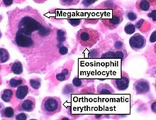 In this section, the fibers clearly predominate. Bone Marrow Wikipedia