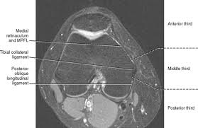 It is the largest synovial joint in the body and allows flexion and extension of the leg as well as some rotation in the flexed position. Imaging Of The Knee Radiology Key