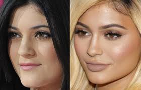 The former 90 day fiance stars have launched season two of their own show, letting cameras capture their relationships through a close lens. Top 25 Celebrities Before And After Plastic Surgery And Nose Jobs