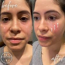 𝐑𝐨𝐠𝐞𝐫 𝐘𝐨𝐧𝐜𝐞 𝐑𝐍 (@right.dose.roger) • Instagram photos and videos