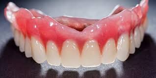 Image result for dentures