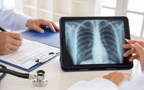 However, the symptoms of lung cancer differ vastly from bronchitis which is one of the commonest affections of chronic smokers. Is My Cough A Lung Cancer Cough