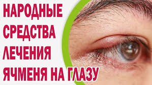 как лечить ячмень на нижнем веке в домашних условиях Kak Lechit Yachmen Na Glazu Narodnymi Sredstvami