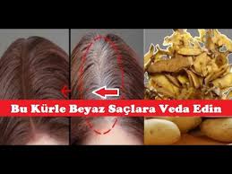 Patates Kabugu Kuru Ile Beyaz Saclara Son Youtube