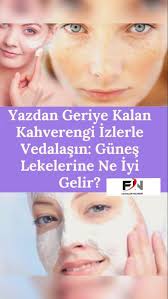 Gunes Lekeleri Icin 7 Dogal Maske Tarifleri Faydalari Nelerdir 2020 Cilt Bakimi Tuyolari Gizli Bilgi Yuz Bakimi