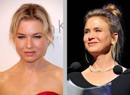 What's it like to go from being unattractive to gorgeous? 10 Cases Of Bad Celebrity Plastic Surgery Fame Focus